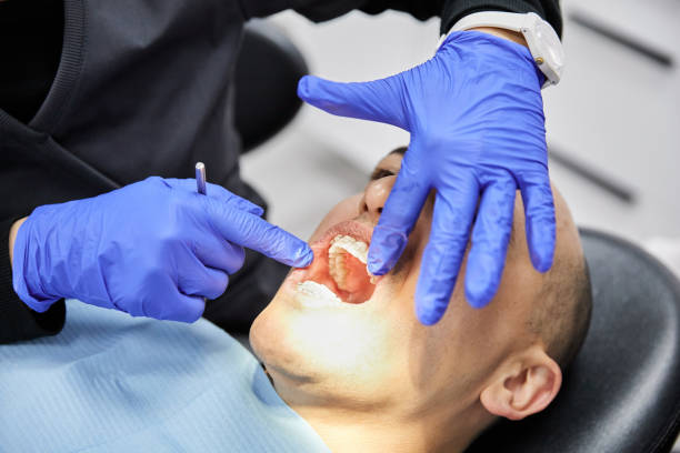 Best Emergency Treatment for Dental Infections or Abscesses in Carthage, TX